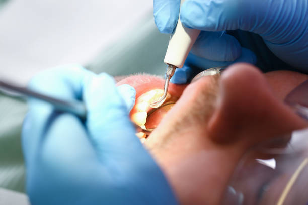 Best Same-Day Emergency Dentist in North Charleroi, PA
