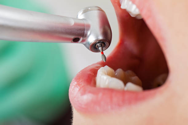 Best Emergency Dental Surgery in North Charleroi, PA